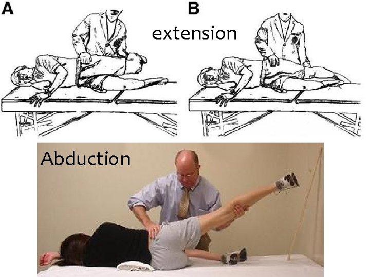 extension Abduction 