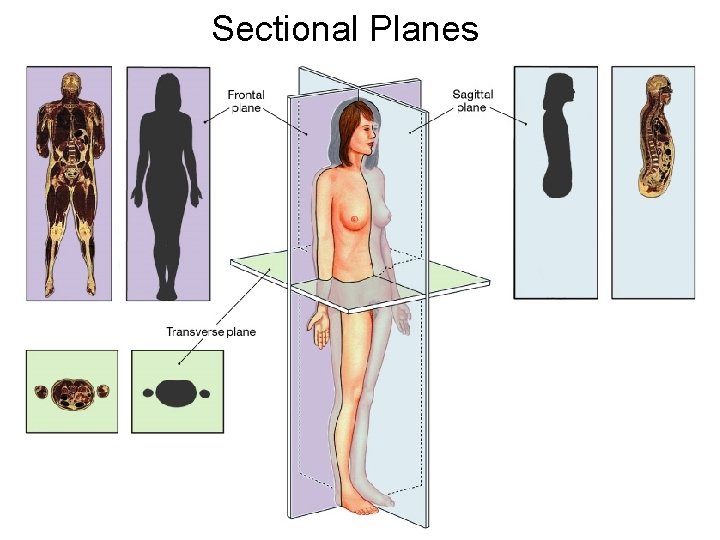 Sectional Planes 