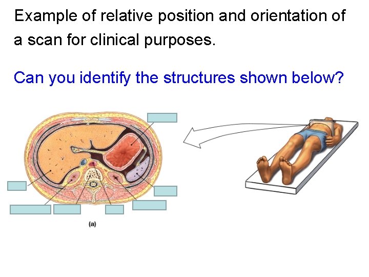 Example of relative position and orientation of a scan for clinical purposes. Can you