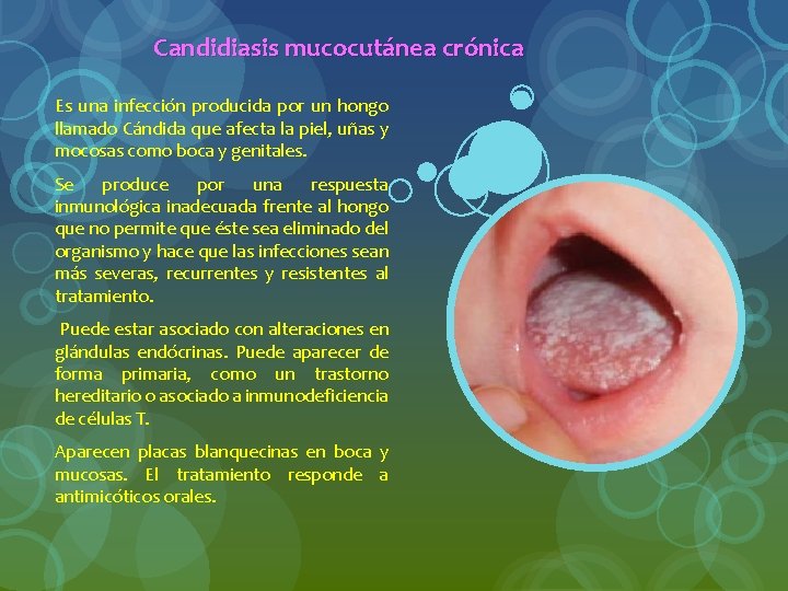 Candidiasis mucocutánea crónica Es una infección producida por un hongo llamado Cándida que afecta