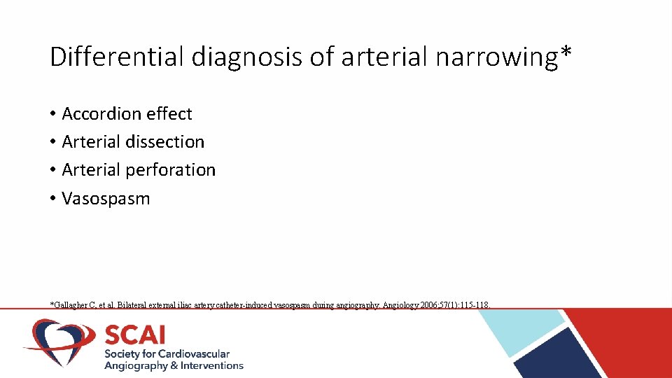 Differential diagnosis of arterial narrowing* • Accordion effect • Arterial dissection • Arterial perforation