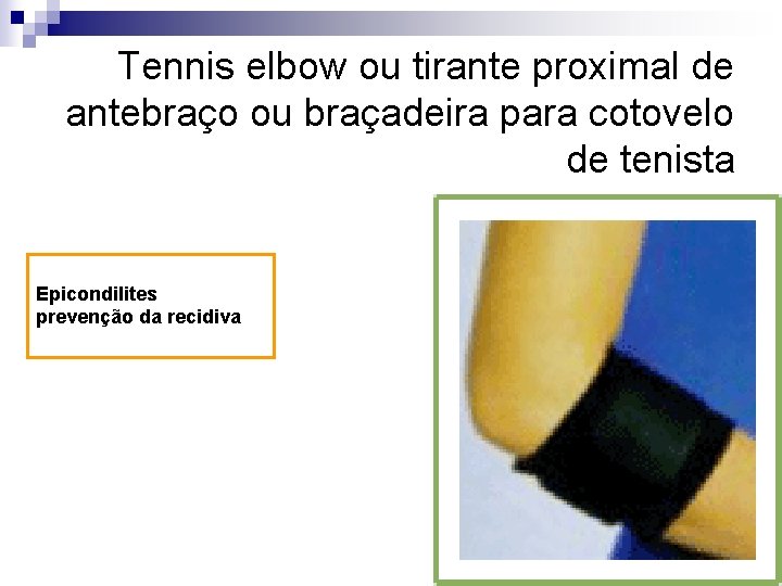 Tennis elbow ou tirante proximal de antebraço ou braçadeira para cotovelo de tenista Epicondilites