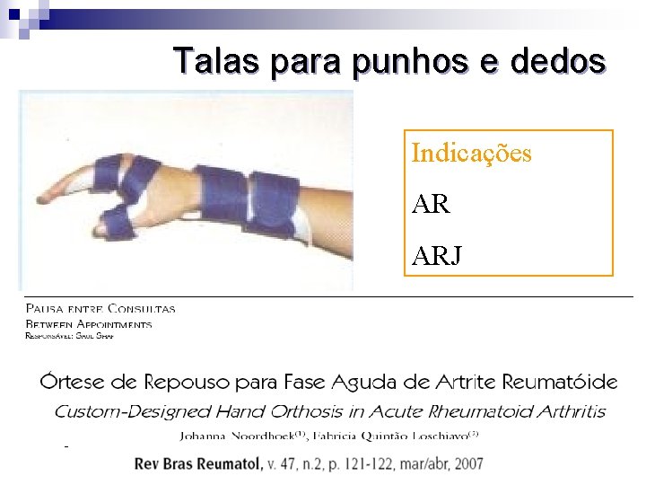 Talas para punhos e dedos Indicações AR ARJ 30° de extensão, metacarpofalangeanas (MCF) em