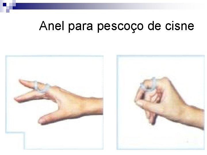 Anel para pescoço de cisne 