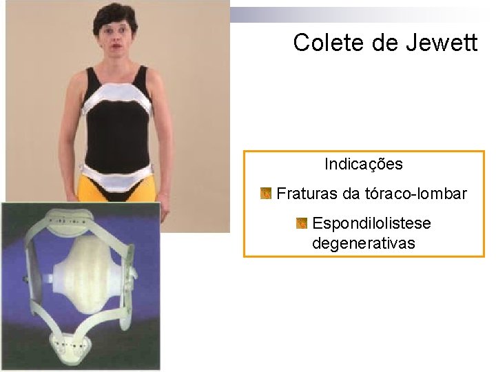 Colete de Jewett Indicações Fraturas da tóraco-lombar Espondilolistese degenerativas 