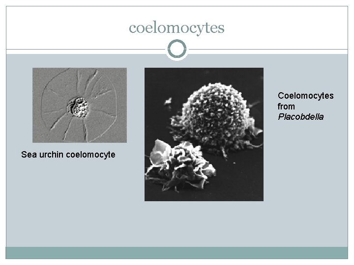 coelomocytes Coelomocytes from Placobdella Sea urchin coelomocyte 