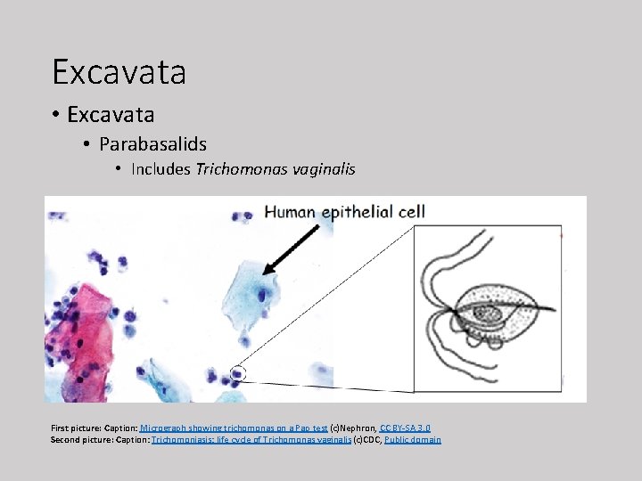 Excavata • Parabasalids • Includes Trichomonas vaginalis First picture: Caption: Micrograph showing trichomonas on