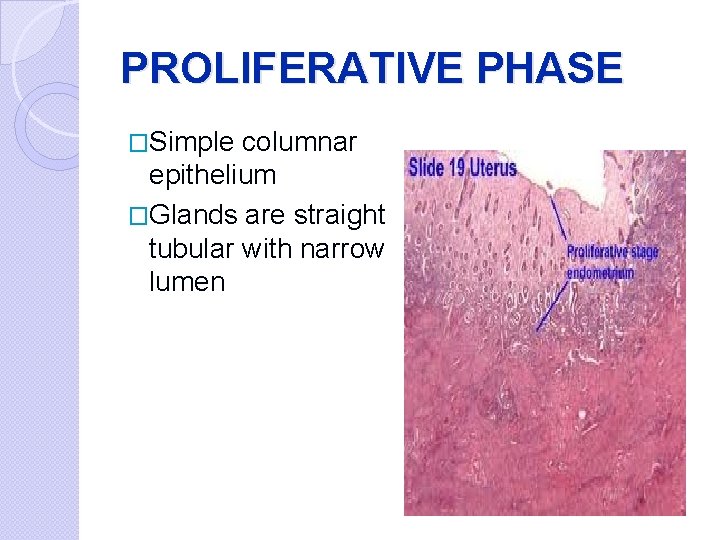 PROLIFERATIVE PHASE �Simple columnar epithelium �Glands are straight tubular with narrow lumen 