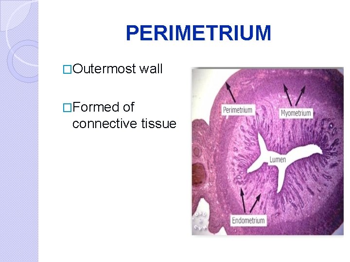 PERIMETRIUM �Outermost �Formed wall of connective tissue 