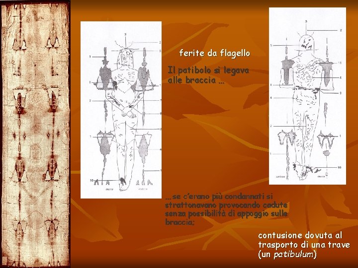 ferite da flagello Il patibolo si legava alle braccia … … se c’erano più