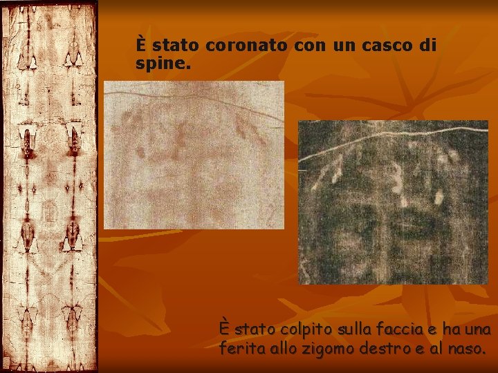 È stato coronato con un casco di spine. È stato colpito sulla faccia e