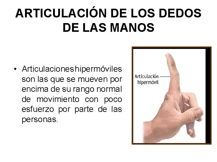 ARTICULACIÓN DE LOS DEDOS DE LAS MANOS • Articulaciones hipermóviles son las que se