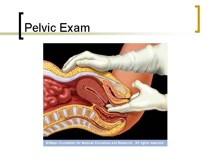 Pelvic Exam 