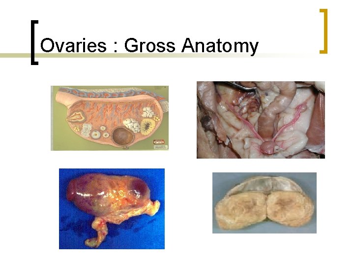 Ovaries : Gross Anatomy 