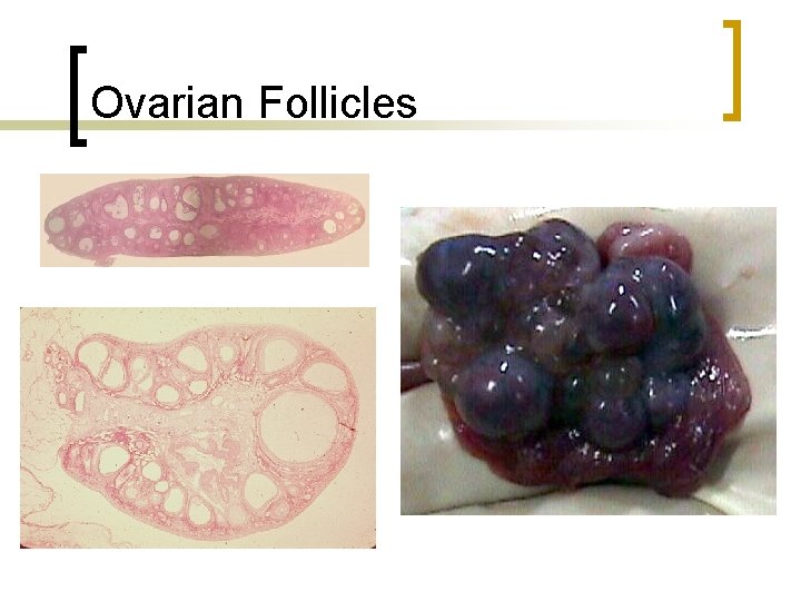 Ovarian Follicles 