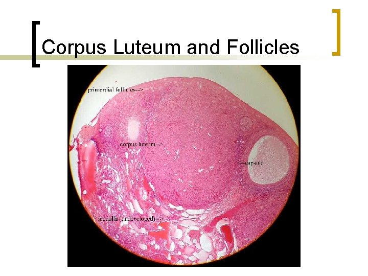 Corpus Luteum and Follicles 