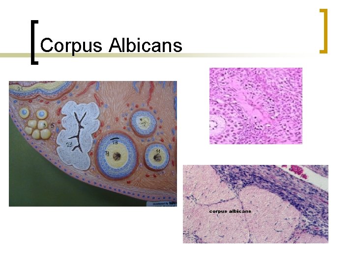 Corpus Albicans 