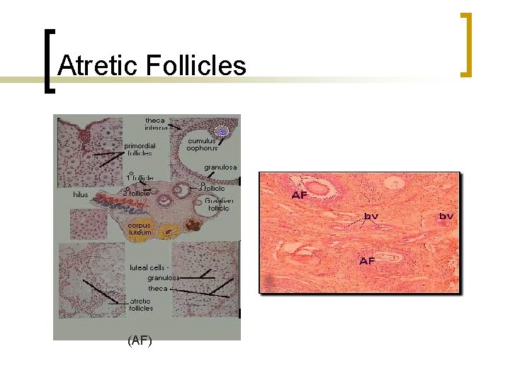 Atretic Follicles (AF) 