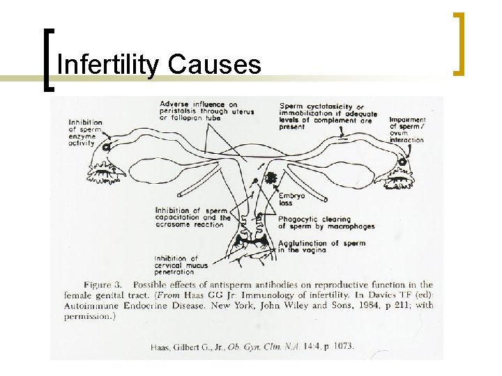 Infertility Causes 