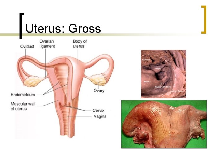 Uterus: Gross 
