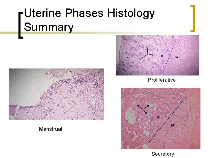 Uterine Phases Histology Summary Proliferative Menstrual Secretory 