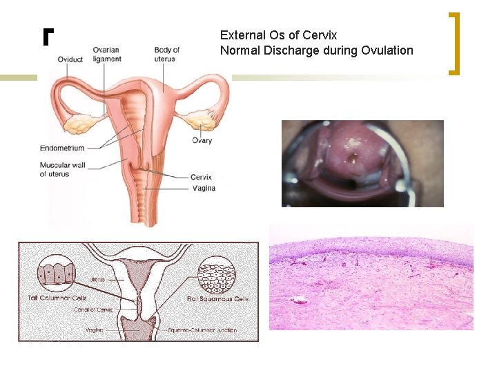 Cervix External Os of Cervix Normal Discharge during Ovulation 