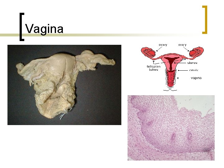 Vagina 