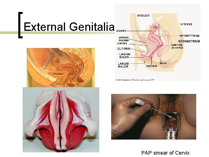 External Genitalia PAP smear of Cervix 