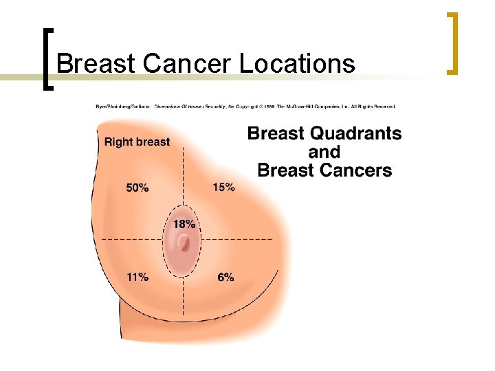 Breast Cancer Locations 