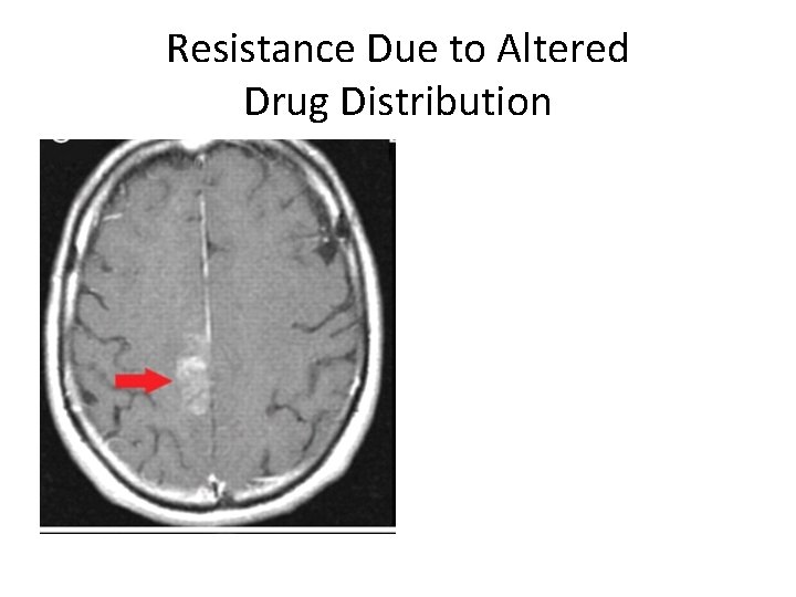 Resistance Due to Altered Drug Distribution 