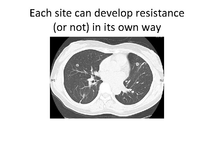 Each site can develop resistance (or not) in its own way 
