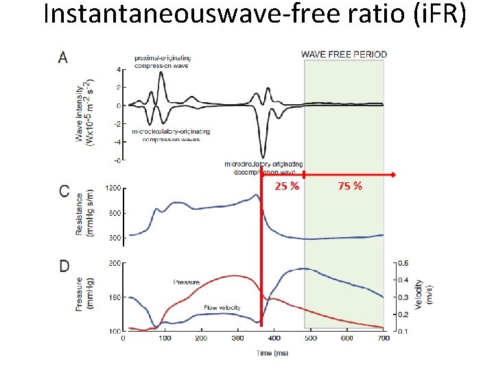 Instantaneouswave-free ratio (i. FR) 