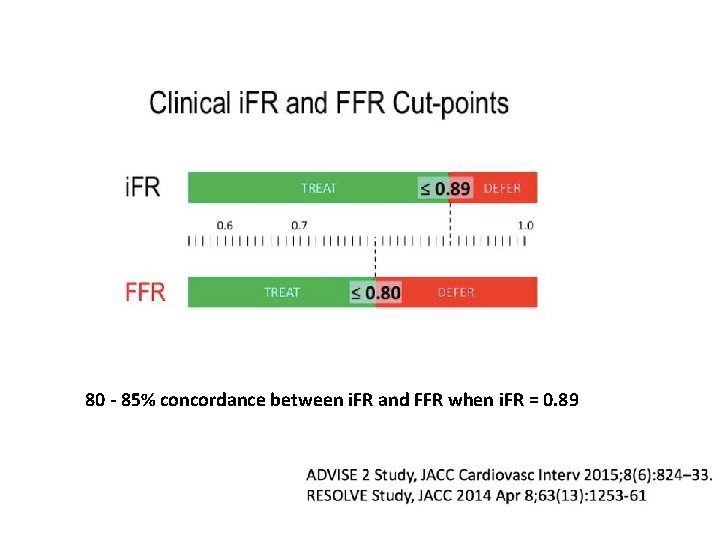 80 - 85% concordance between i. FR and FFR when i. FR = 0.