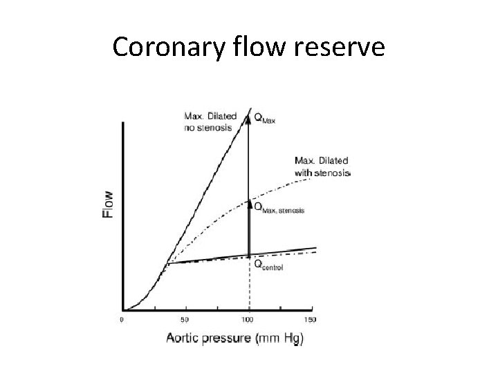 Coronary flow reserve 