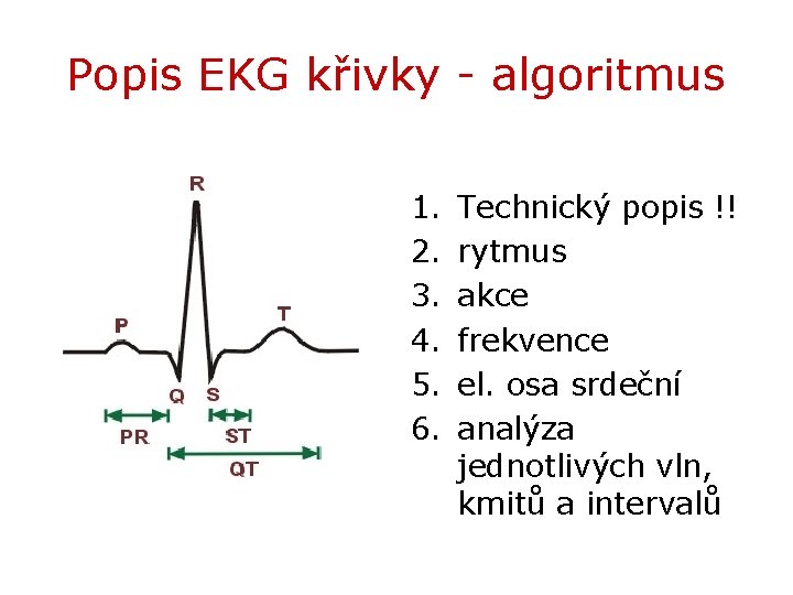 Popis EKG křivky - algoritmus 1. 2. 3. 4. 5. 6. Technický popis !!