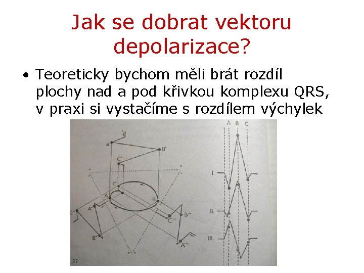Jak se dobrat vektoru depolarizace? • Teoreticky bychom měli brát rozdíl plochy nad a