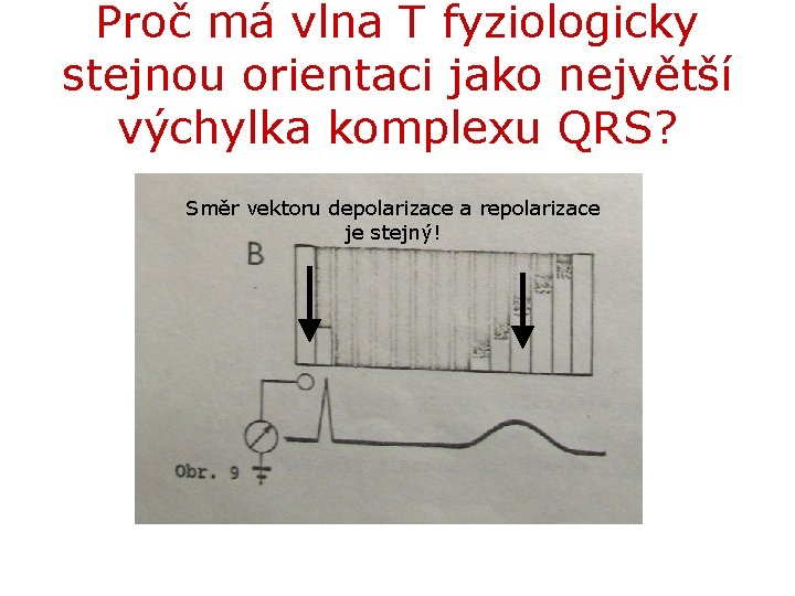 Proč má vlna T fyziologicky stejnou orientaci jako největší výchylka komplexu QRS? Směr vektoru