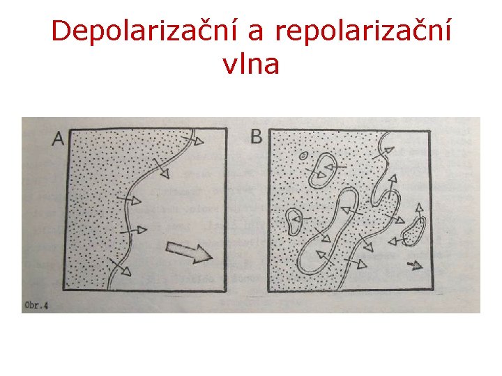 Depolarizační a repolarizační vlna 