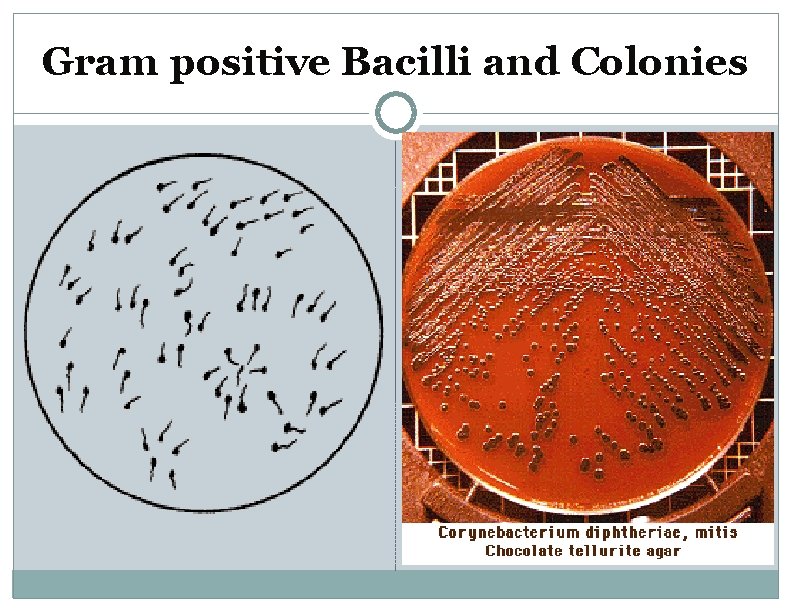 Gram positive Bacilli and Colonies 