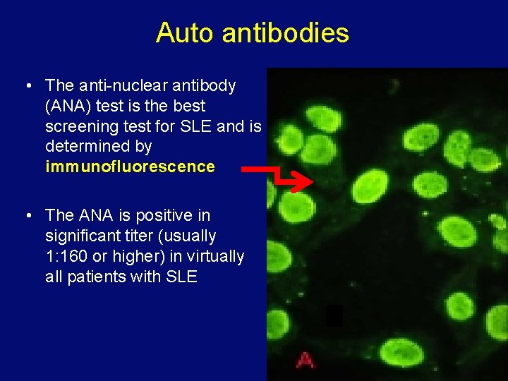 Auto antibodies • The anti-nuclear antibody (ANA) test is the best screening test for