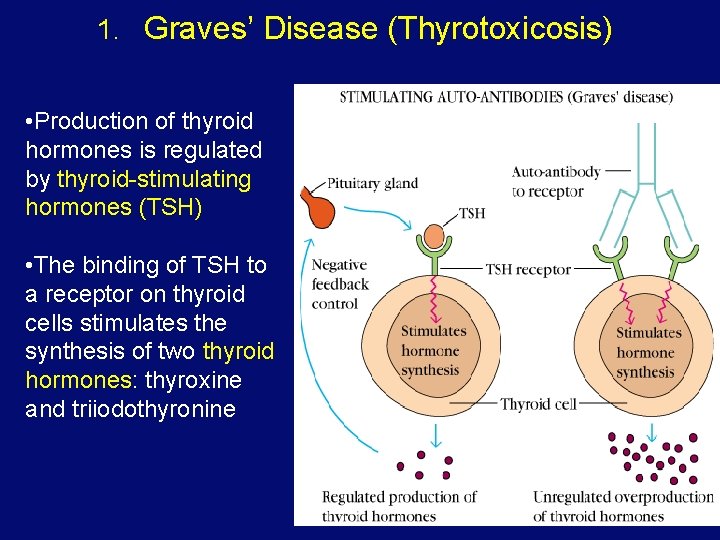 1. Graves’ Disease (Thyrotoxicosis) • Production of thyroid hormones is regulated by thyroid-stimulating hormones
