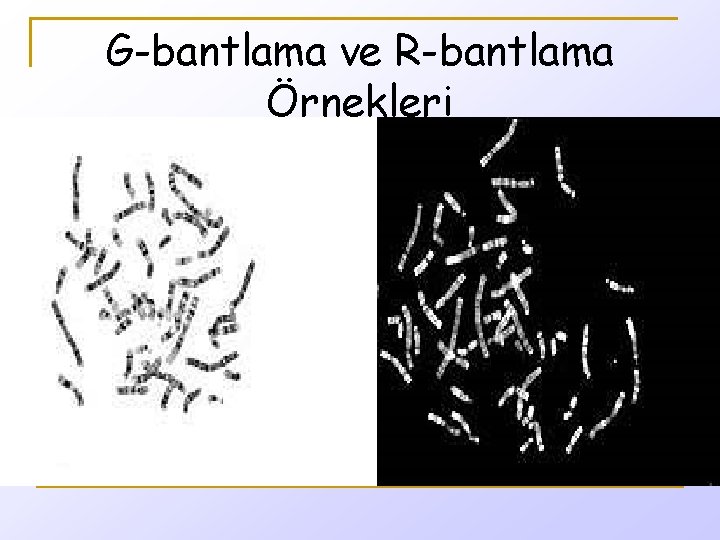 G-bantlama ve R-bantlama Örnekleri 