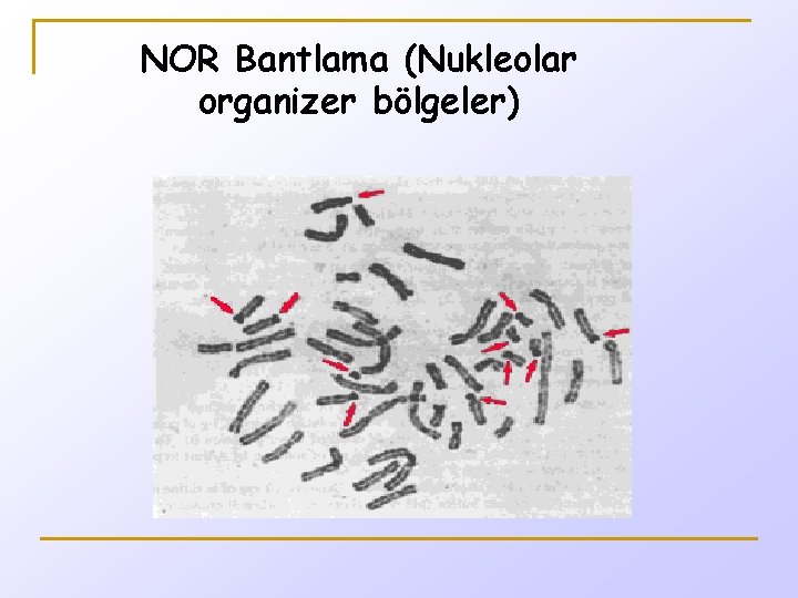 NOR Bantlama (Nukleolar organizer bölgeler) 