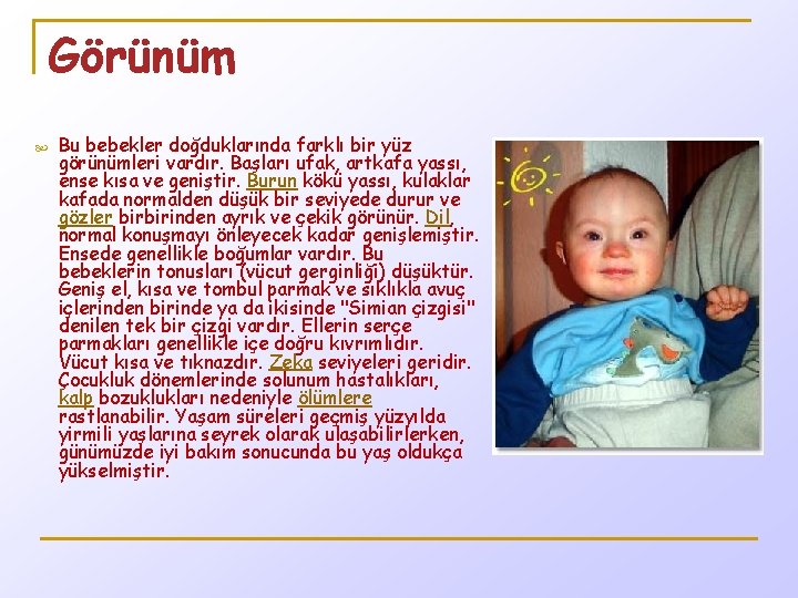 Görünüm Bu bebekler doğduklarında farklı bir yüz görünümleri vardır. Başları ufak, artkafa yassı, ense