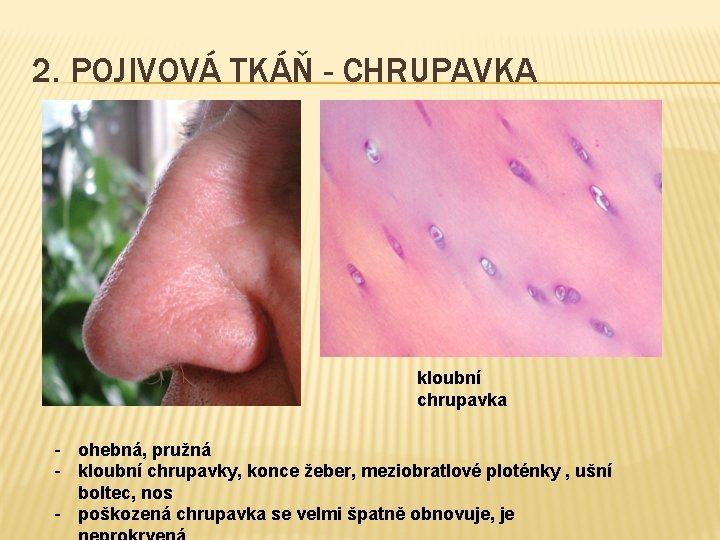 2. POJIVOVÁ TKÁŇ - CHRUPAVKA kloubní chrupavka - ohebná, pružná - kloubní chrupavky, konce