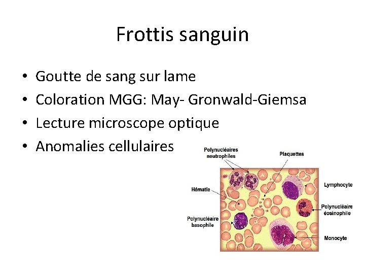 Frottis sanguin • • Goutte de sang sur lame Coloration MGG: May- Gronwald-Giemsa Lecture