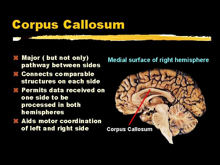 Corpus Callosum Major ( but not only) Medial surface of right hemisphere pathway between