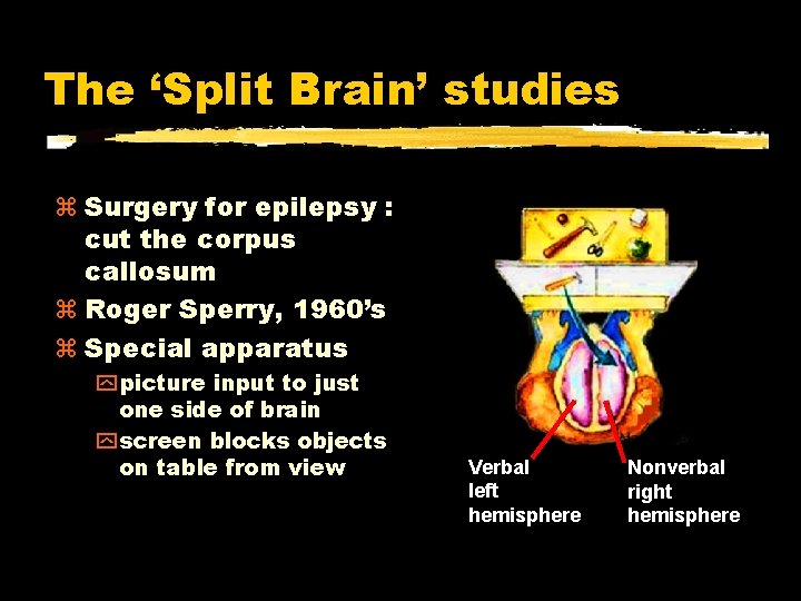 The ‘Split Brain’ studies Surgery for epilepsy : cut the corpus callosum Roger Sperry,