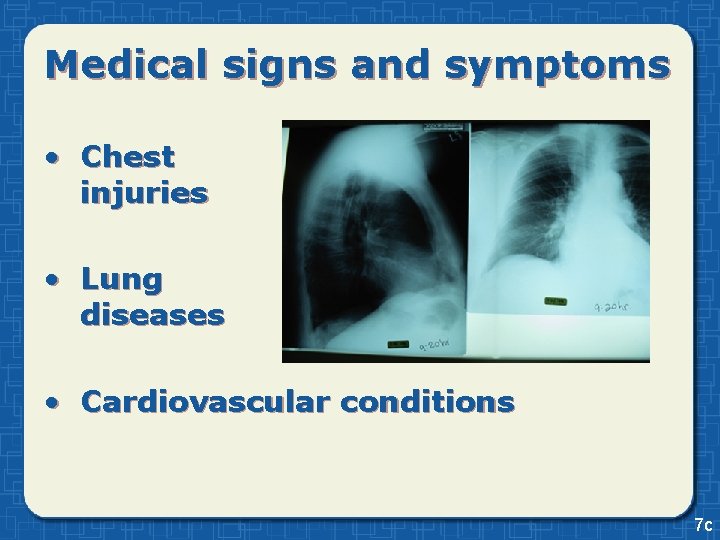 Medical signs and symptoms • Chest injuries • Lung diseases • Cardiovascular conditions 7