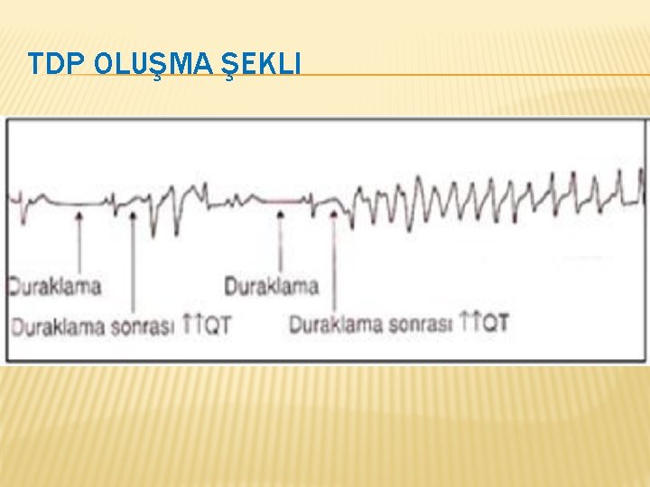 TDP OLUŞMA ŞEKLI 